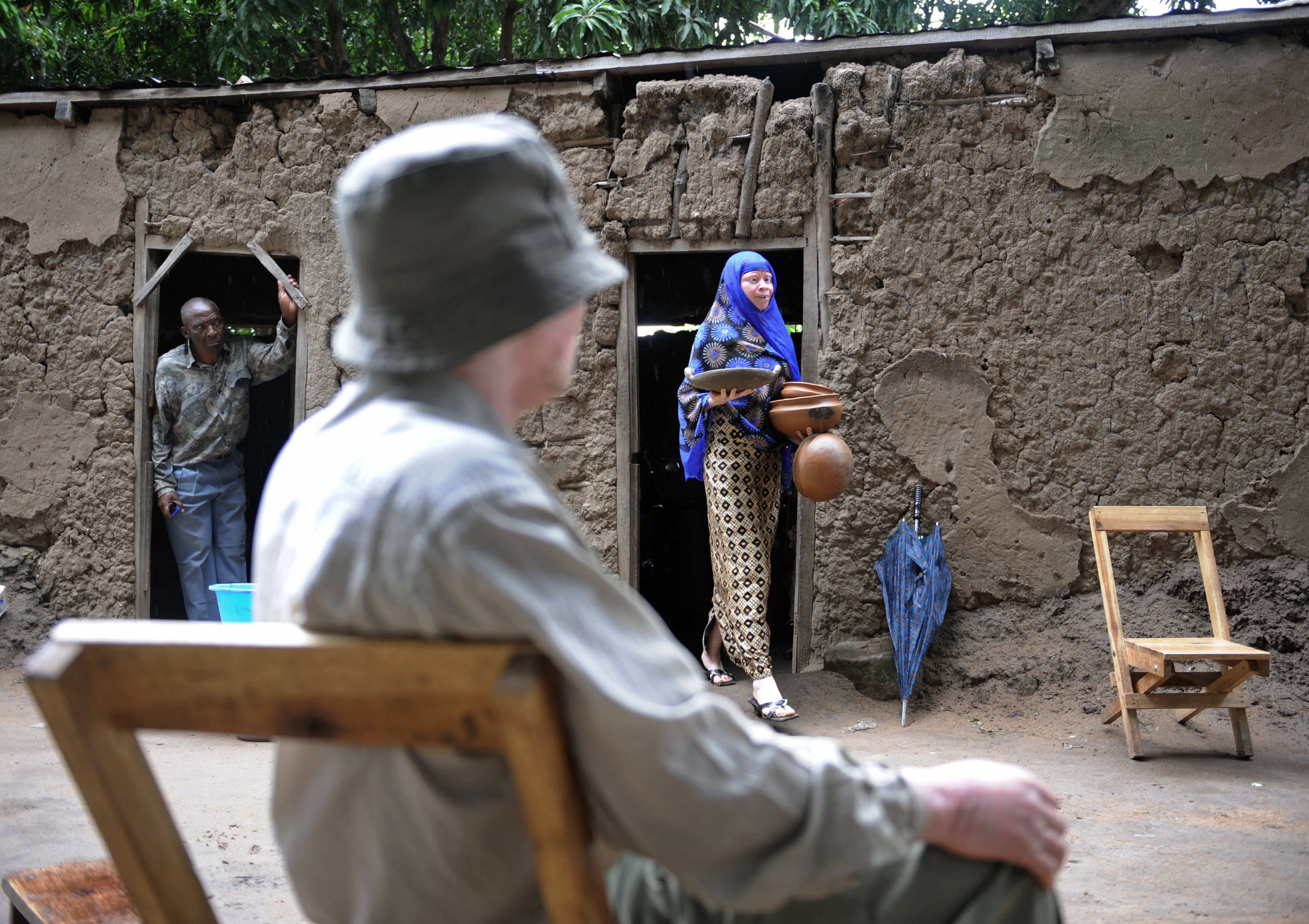 Albino vermoord in Malawi, daders krijgen doodstraf
