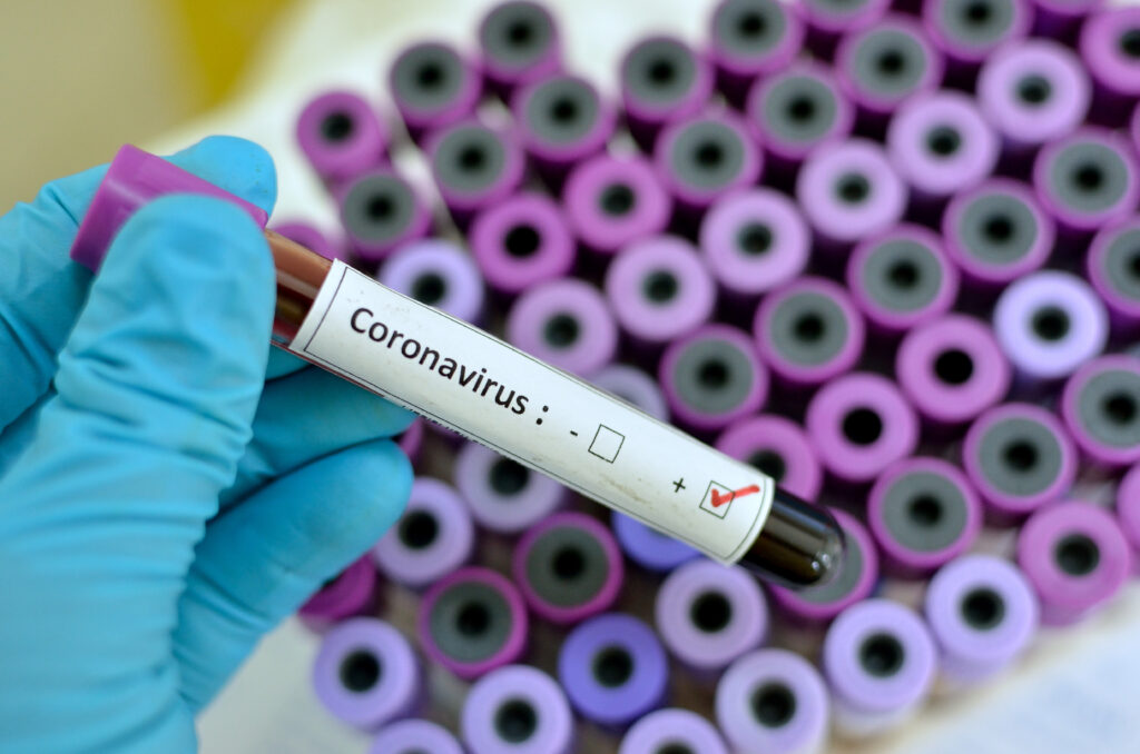 Viroloog: niet teveel inzoomen op de Britse coronavirus variant